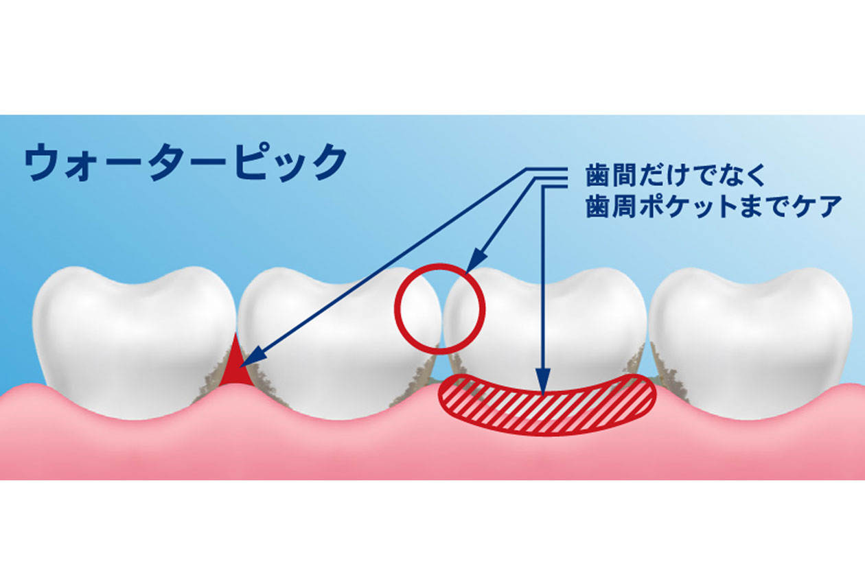 ウォーターピック＞コードレスセレクト – カチモ | カチあるモノで価値